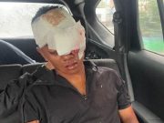 PARAH!!! Geng Motor Bersajam Aniaya Oknum TNI di Medan