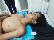 Tawuran Gemot Di Jalan Bandara Kualanamu, Siswa SMA Tewas