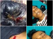 Parang Melayang, Leher Dan Kepala Ridwan Koyak Dibacok Preman