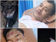 Dua Pemuda Terluka Diserang Begal Bersajam