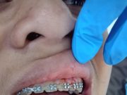 Santri Pesantren di Selayang Trauma Berat Usai Dianiaya Temannya Sendiri