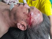 Wartawan Online di Medan Tewas Mengenaskan