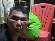 Diduga Penculik Anak, Babak Belur Dibal-bal Warga di Tanjung Morawa