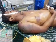 Diduga Ketahuan Maling Besi, Situmeang Tewas